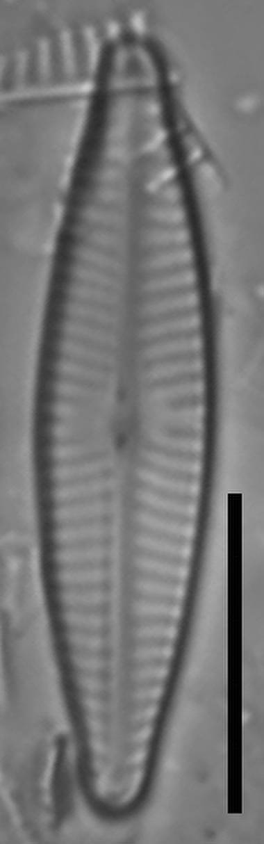 Масштаб – 10 мкм., Одинцовский район, Moscow Oblast (Russia)