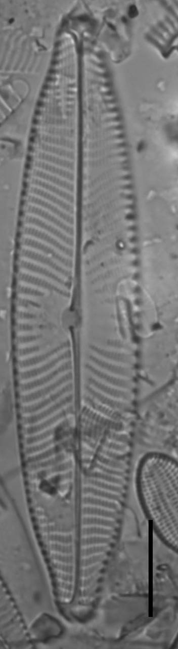 Масштаб – 10 мкм., Одинцовский район, Moscow Oblast (Russia)