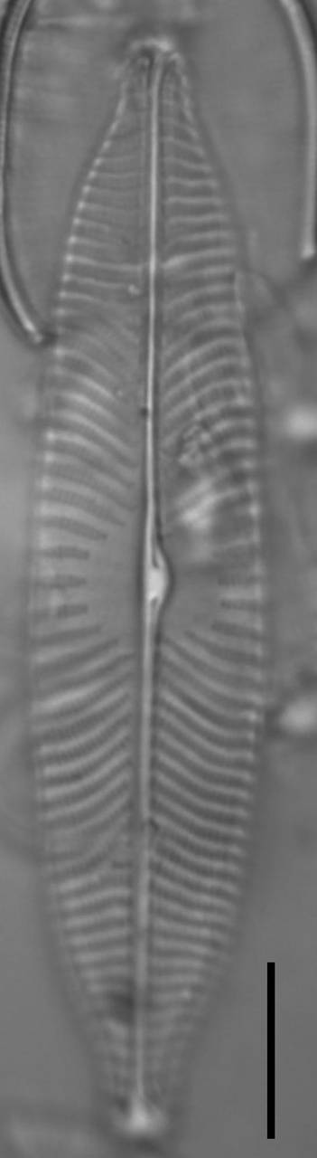 Масштаб – 10 мкм., Одинцовский район, Moscow Oblast (Russia)