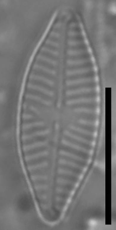 Масштаб – 10 мкм., Одинцовский район, Moscow Oblast (Russia)