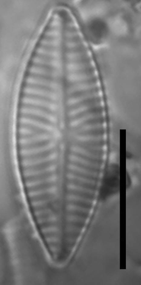 Масштаб – 10 мкм., Одинцовский район, Moscow Oblast (Russia)