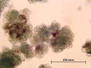 Суспензионная культура Polyscias fruticosa под микроскопом