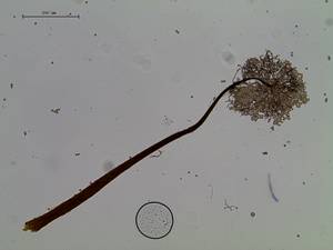 Paradiacheopsis longipes внешний вид спорангия на ножке в проходящем свете, Терский, Мурманская область (Россия)