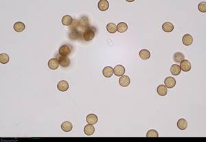 Stemonitis lignicola - споры в проходящем свете, Локнянский, Псковская область (Россия)