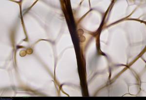 Stemonitopsis aequalis - внутренняя сеть капиллиция, колонка и споры, Бежаницкий, Псковская область (Россия)