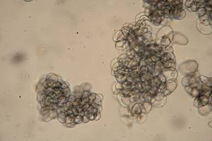 Суспензионная культура клеток Triticum timopheevii под микроскопом