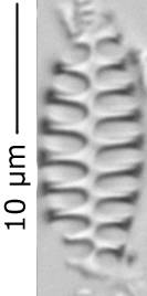 Staurosirella_mart_280-290, о. Шемья (Shemya), Аляска (США)