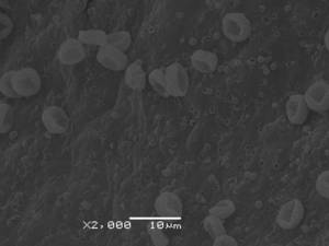 Lindbladia tubulina - Внутренняя поверхность перидия и споры, СЭМ, Селивановский, Владимирская область (Россия)