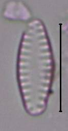 Масштаб - 10 мкм., Рузский район, Московская область (Россия)