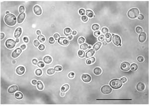 Phase contrast micrograph of Candida sphagnicola sp. nov. KBP Y-3887. Vegetative cells reproducing by budding after 3 days on GPY agar at room temperature,bar = 10 mkm, Тверская область (Россия)