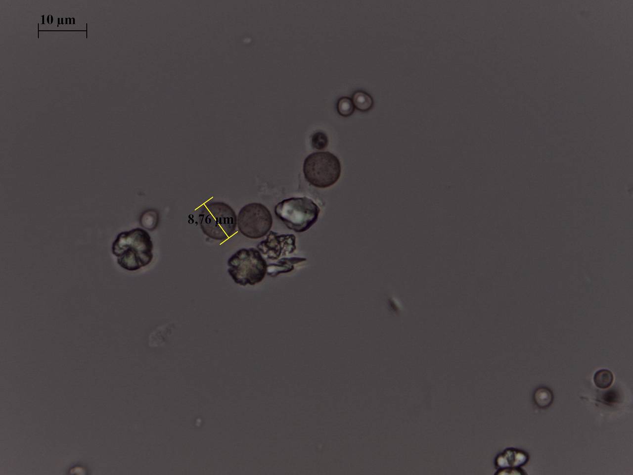 Cribraria microcarpa - споры × 1000, Лазовский, Приморский край (Россия)
