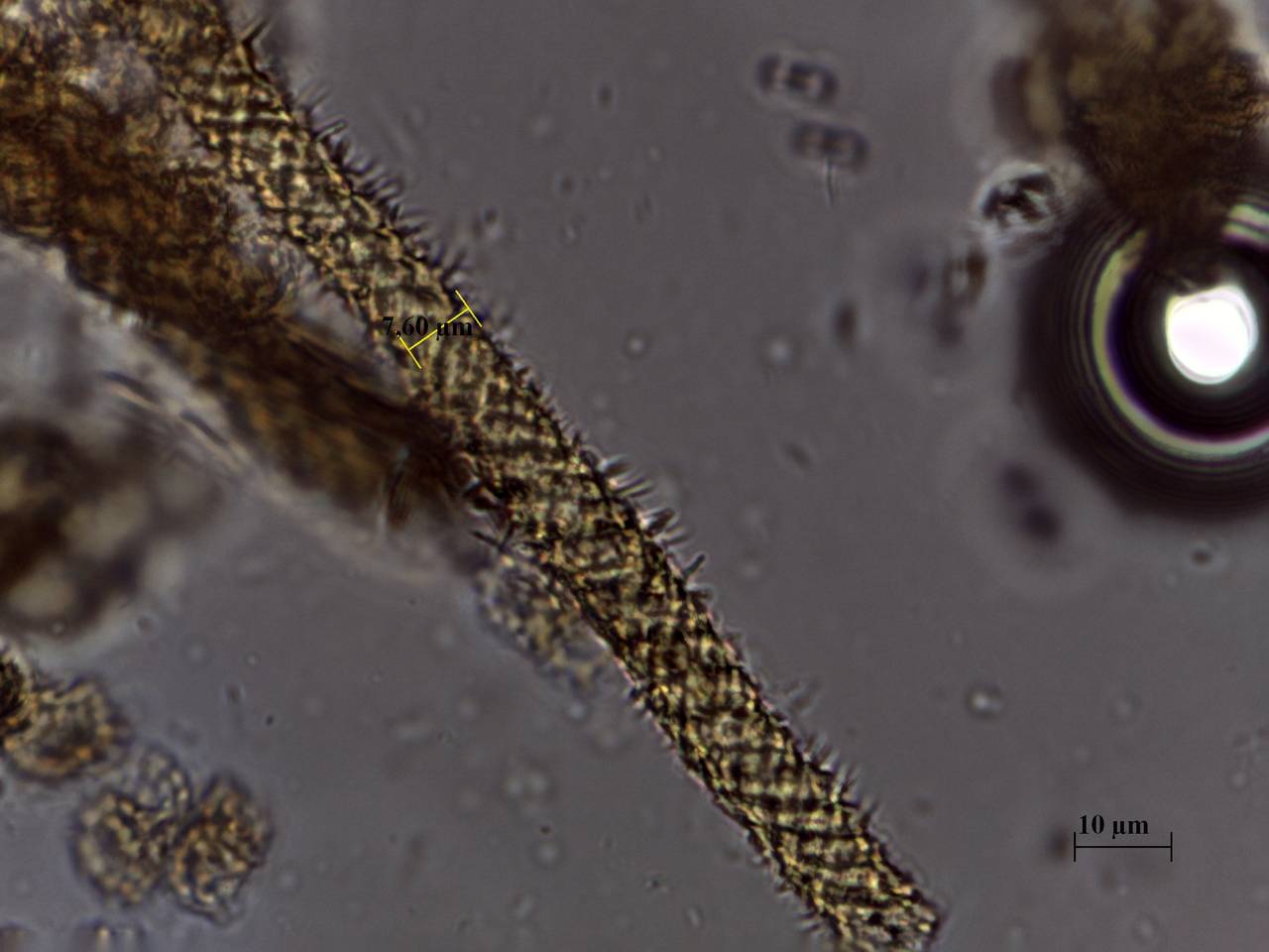Hemitrichia serpula - фрагмент сети капиллиция × 1000, Нелидовский, Тверская область (Россия)