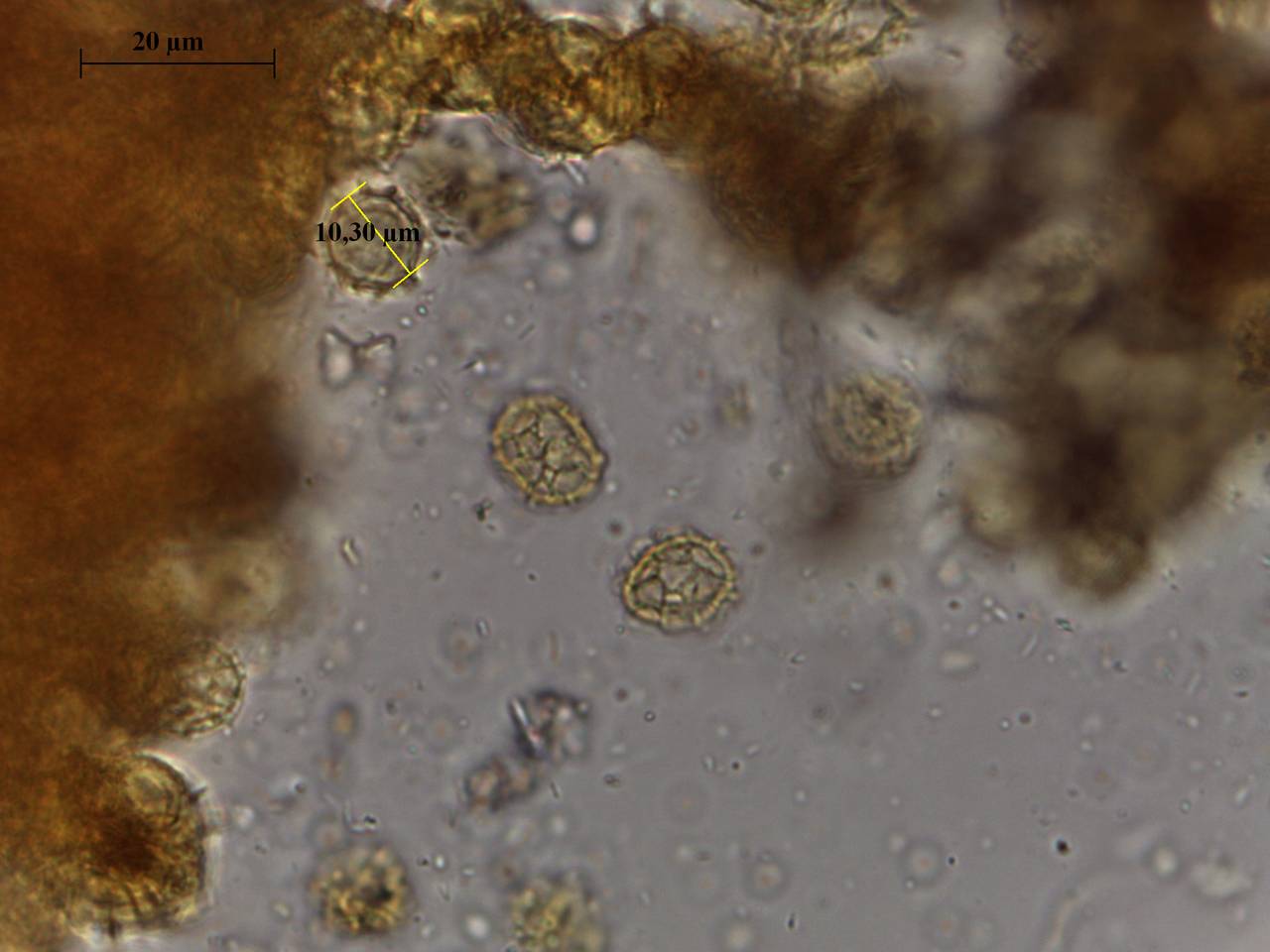 Hemitrichia serpula - фрагмент сети капиллиция × 1000, Нелидовский, Тверская область (Россия)