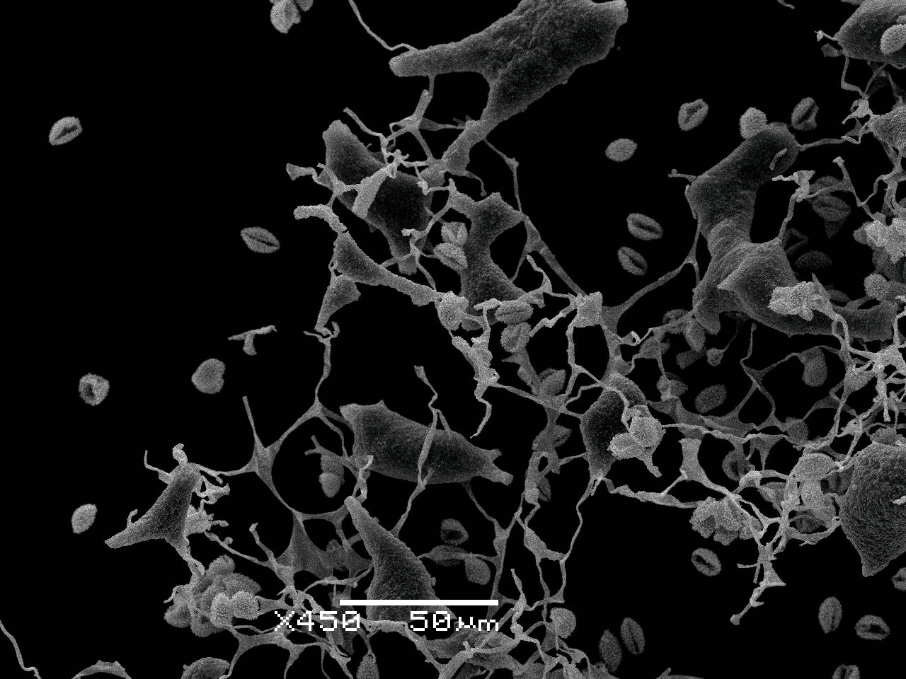 Physarum contextum - Сеть капиллиция с узелками и спорами, СЭМ, Нелидовский, Тверская область (Россия)