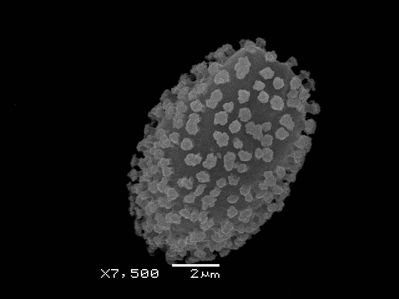 Physarum contextum - Сеть капиллиция с узелками и спорами, СЭМ, Нелидовский, Тверская область (Россия)