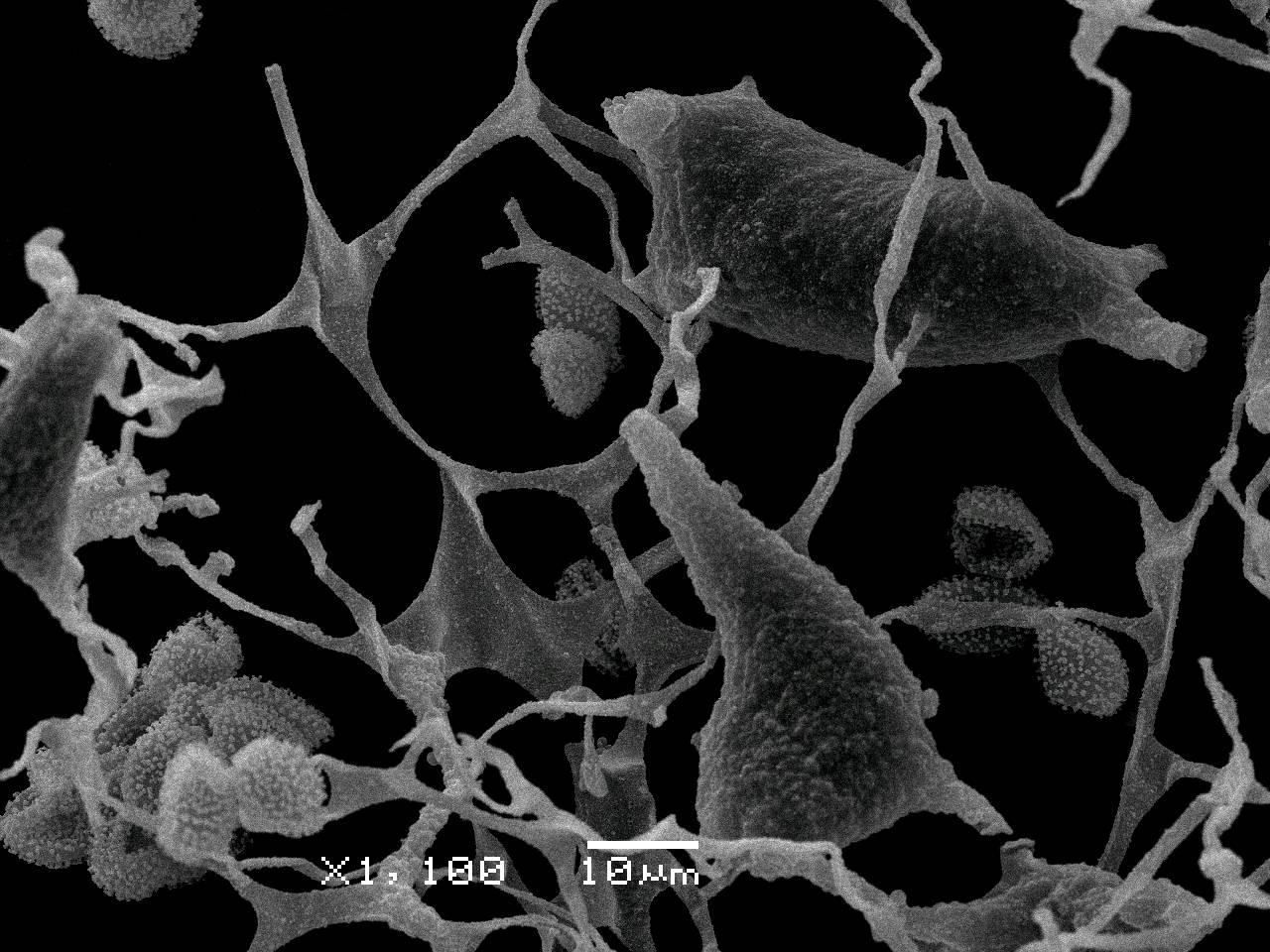 Physarum contextum - Сеть капиллиция с узелками и спорами, СЭМ, Нелидовский, Тверская область (Россия)