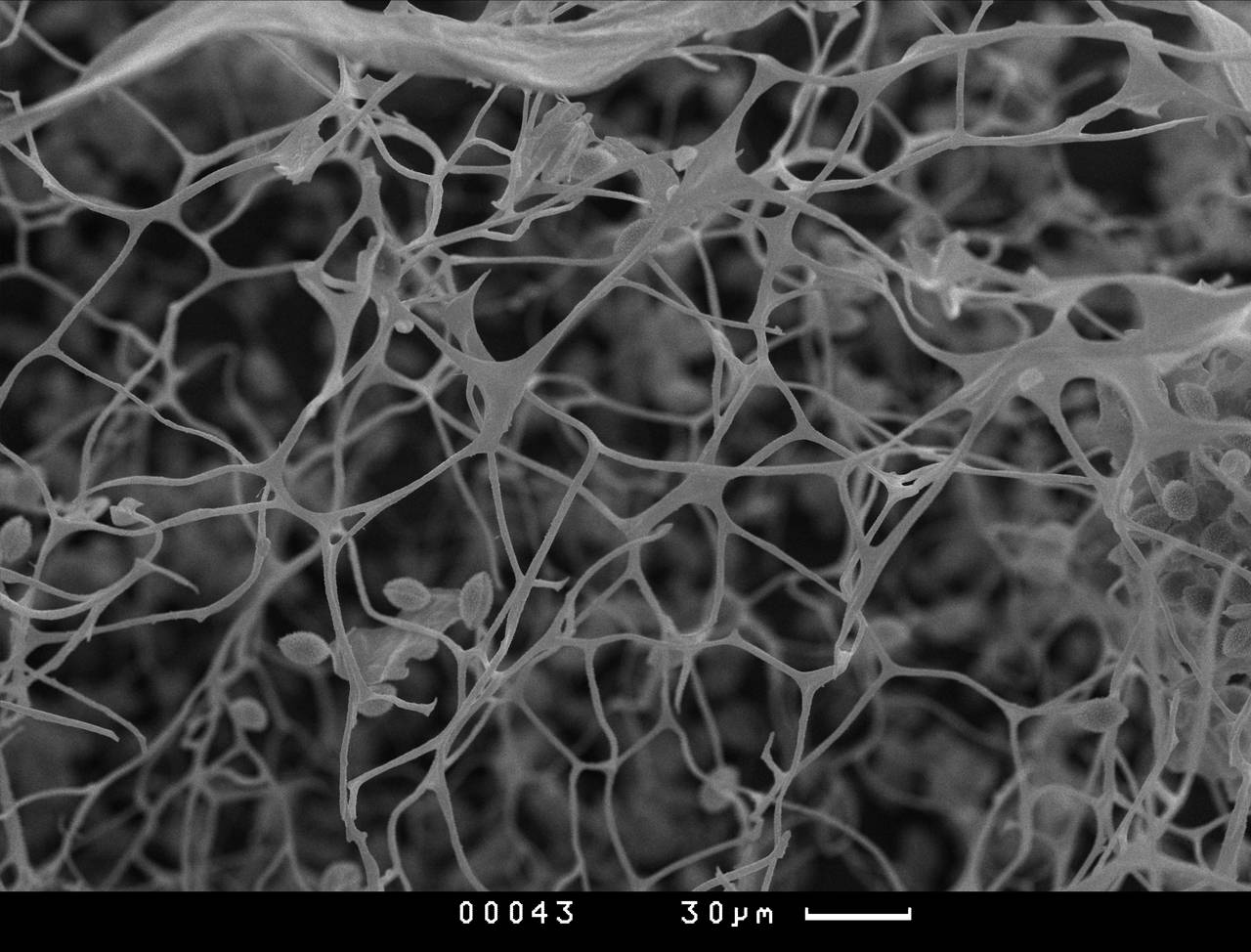 Meriderma aggregatum - сеть капиллиция, СЭМ, Нелидовский, Тверская область (Россия)
