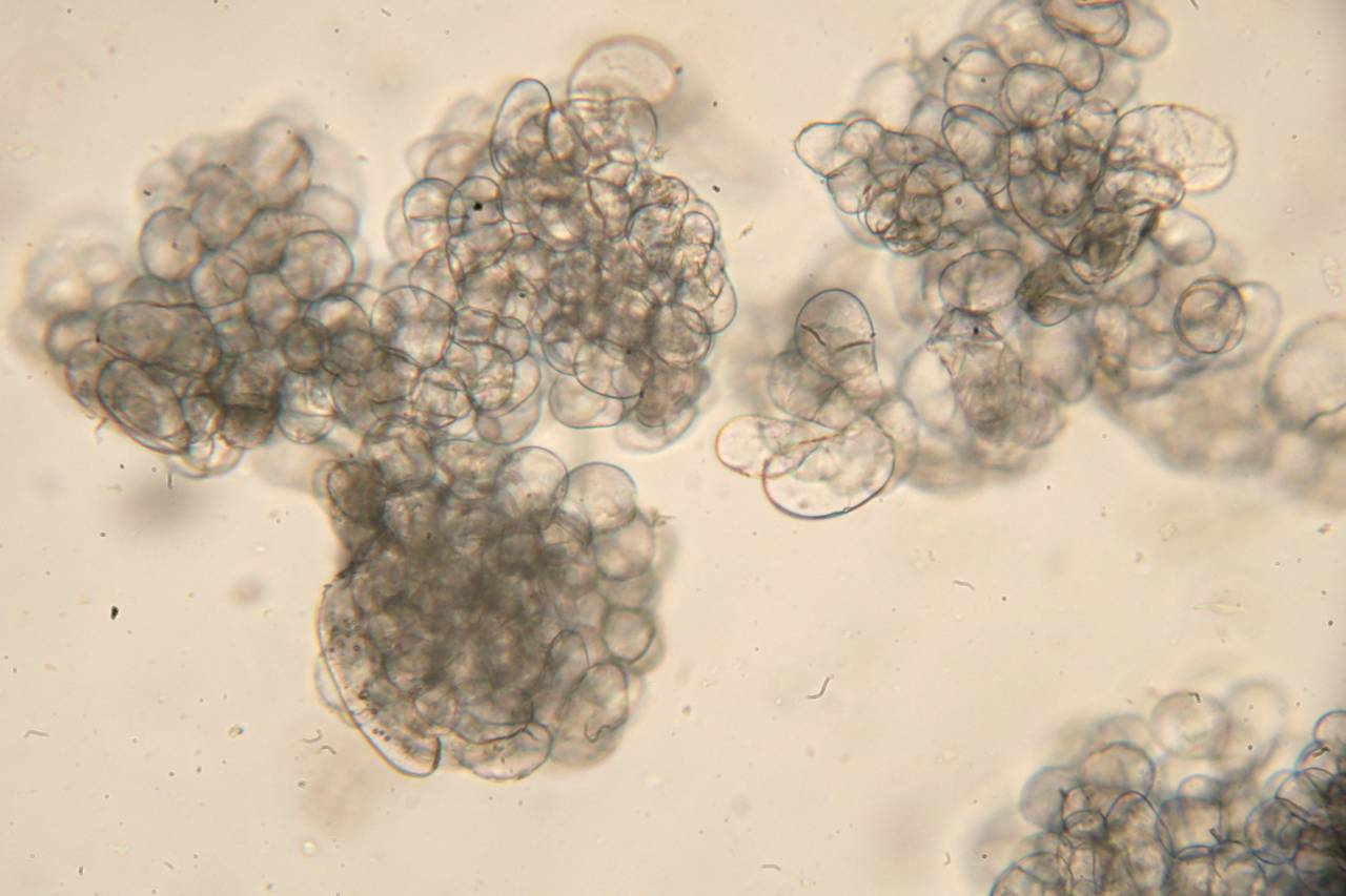 Суспензионная культура клеток Beta vulgaris под микроскопом