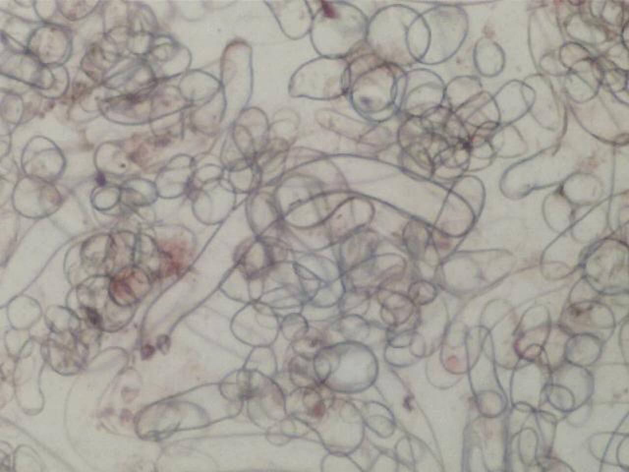 Суспензионная культура клеток Tribulus terrestris под микроскопом