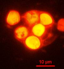 внешний вид и  ультратонкий срез клеток клеток штамма, Тверская область (Россия)