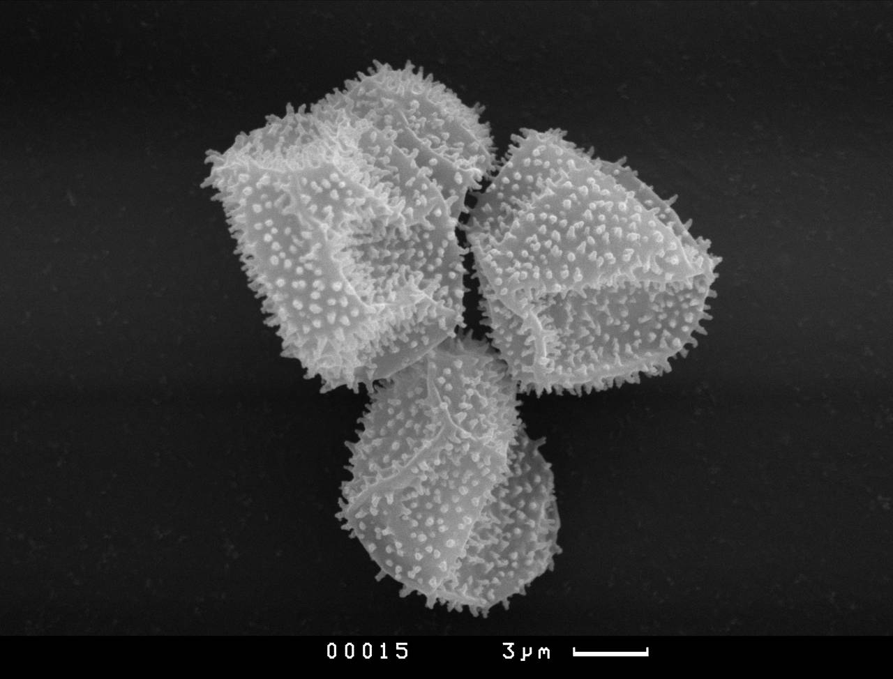 Physarum polycephalum, узелки капиллиция и споры, СЭМ, (Россия)