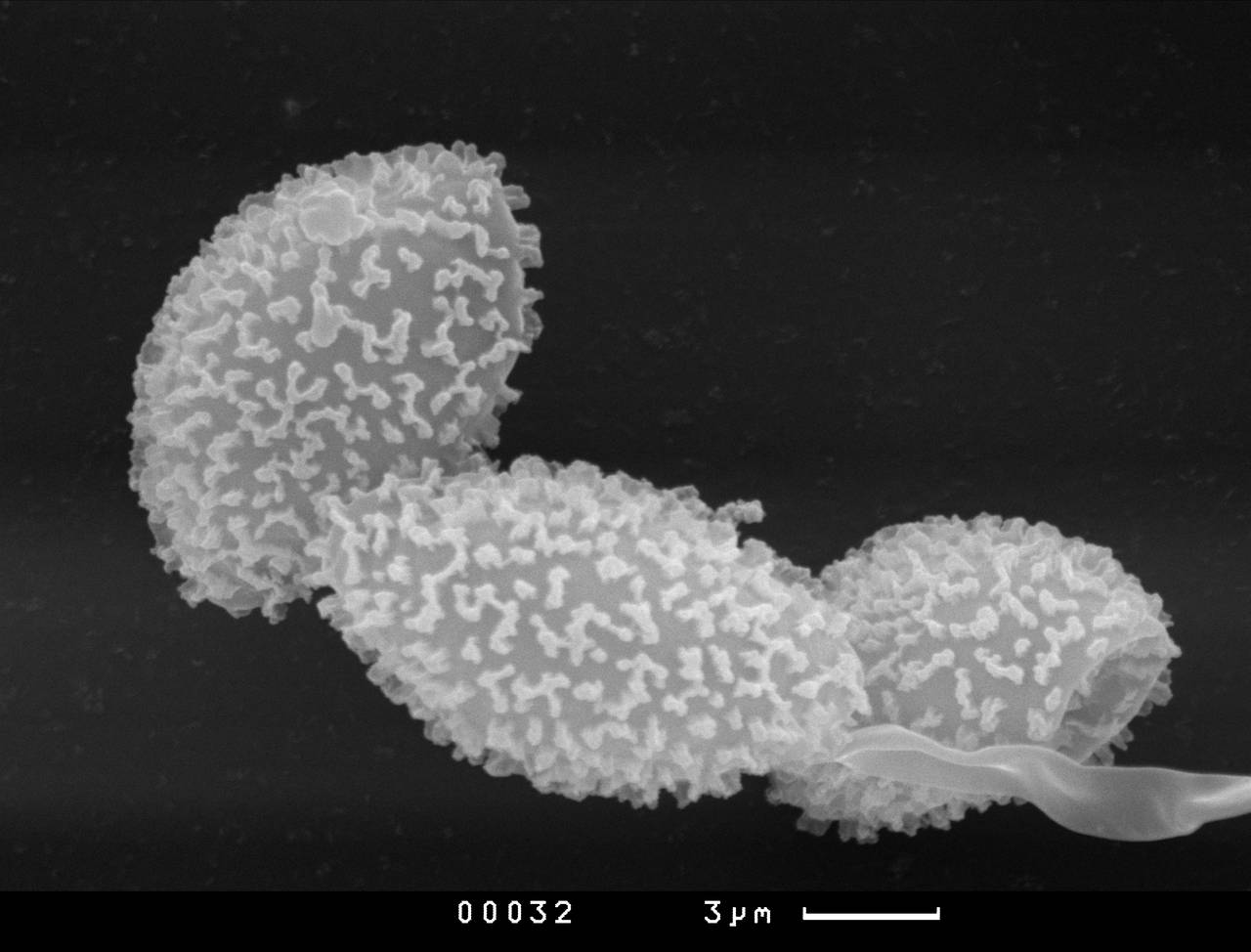 Diacheopsis nannengae, споры и фрагмент капиллиция, СЭМ, Терский, Мурманская область (Россия)