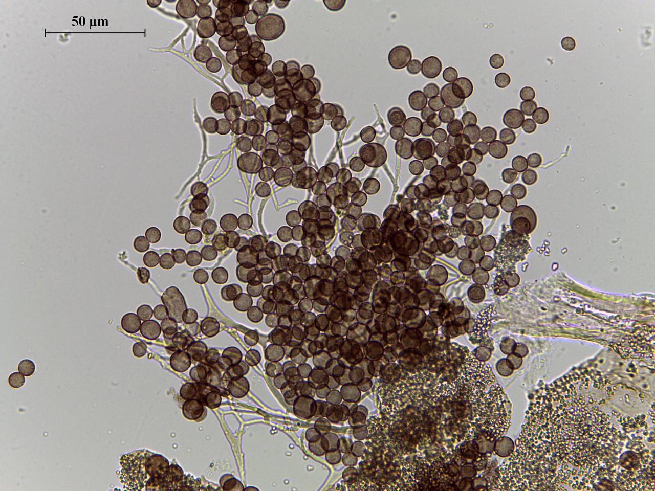 Diderma chondrioderma споры в проходящем свете × 1000, Калининский, Тверская область (Россия)