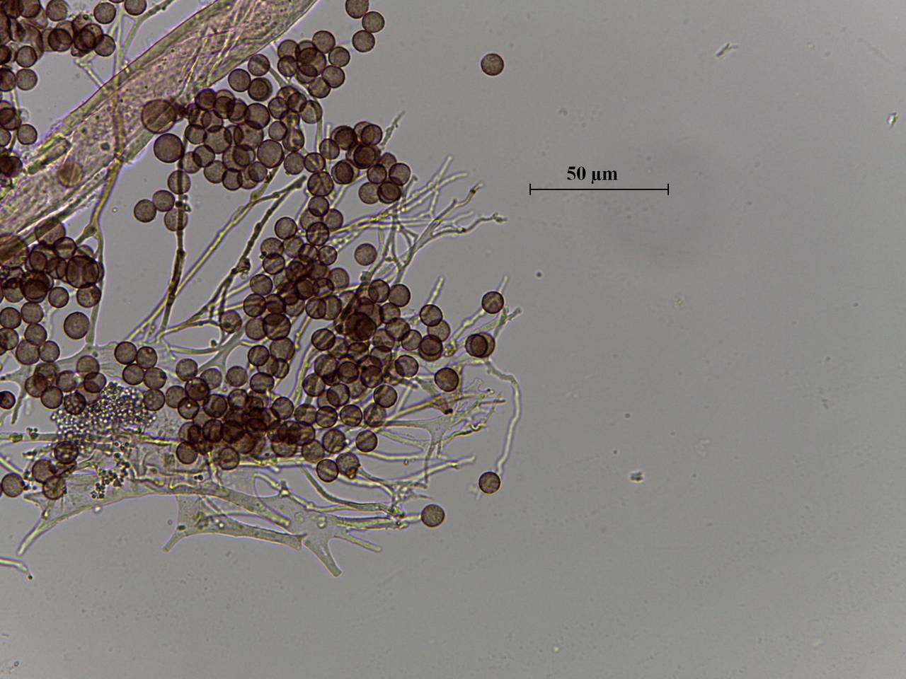 Diderma chondrioderma споры в проходящем свете × 1000, Калининский, Тверская область (Россия)
