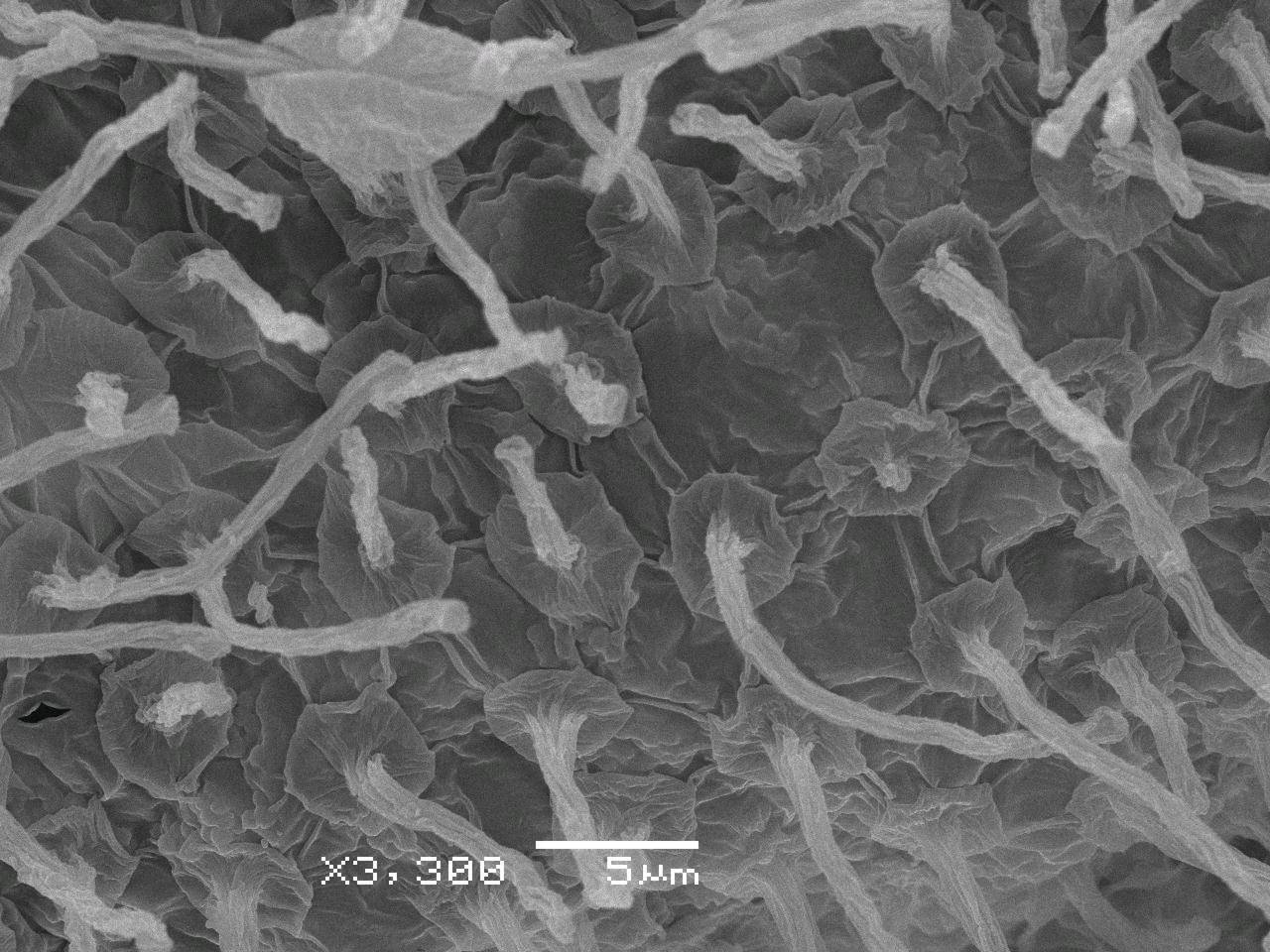 Certiomyxa fruticulosa, споры на индивидуальных ножках, СЭМ, Нелидовский, Тверская область (Россия)