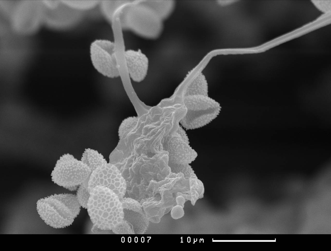 Cribraria piriformis, споры, СЭМ, Нелидовский, Тверская область (Россия)