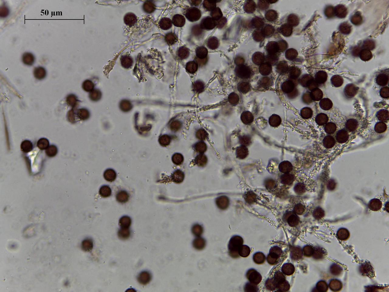 Physarum pezizoideum - капиллиций и споры × 1000, Каневской, Краснодарский край (Россия)